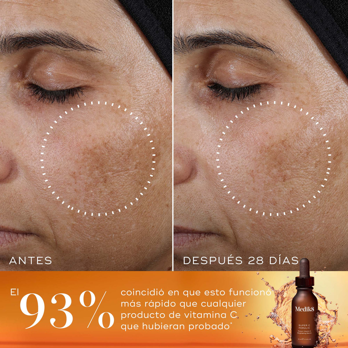 Antes y después — estudio del laboratorio