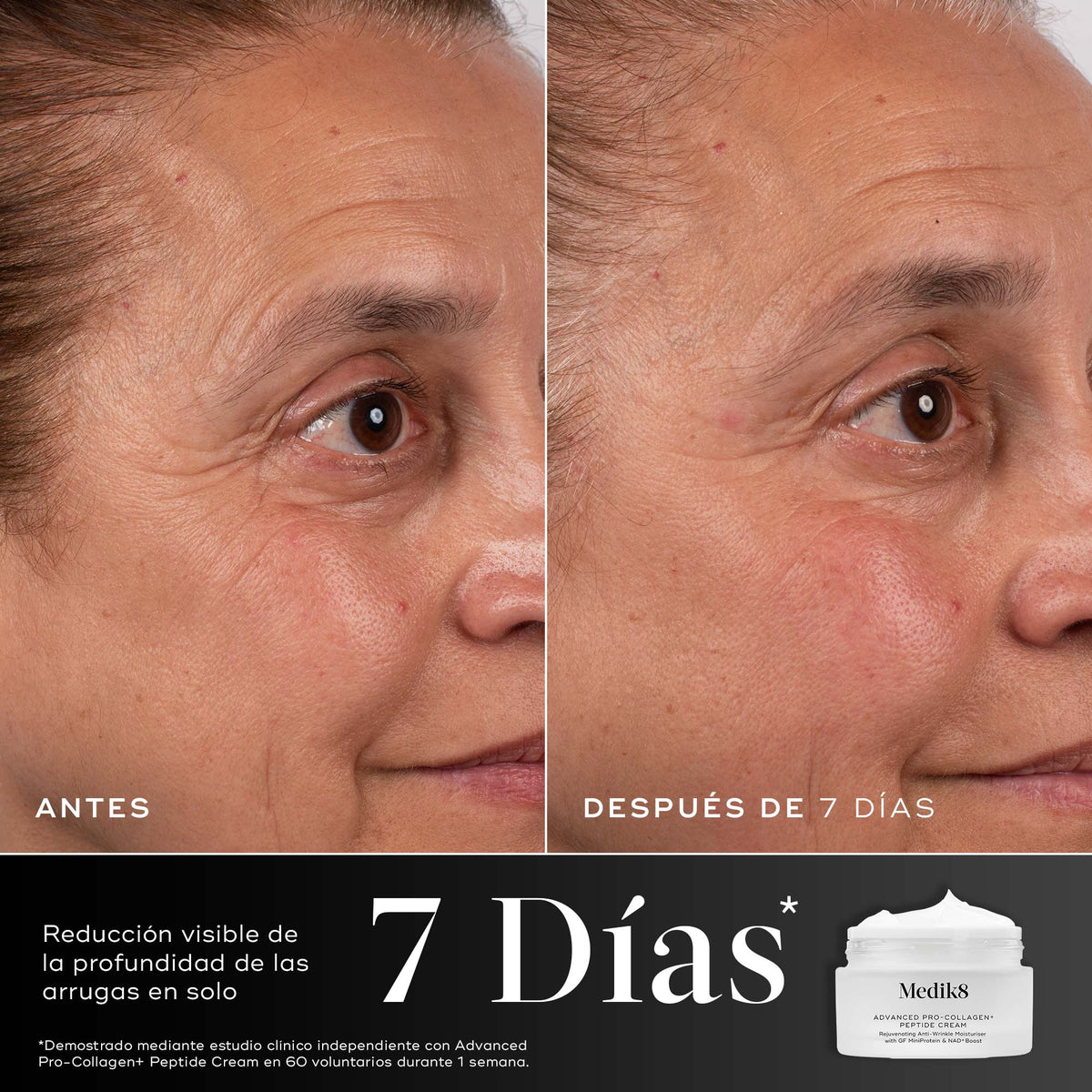 Antes y después — estudio del laboratorio
