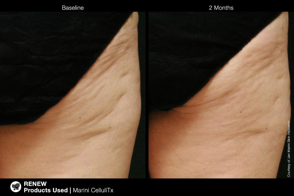 Marini CelluliTx Cellulite Cream Jan Marini 114g (vista 3)