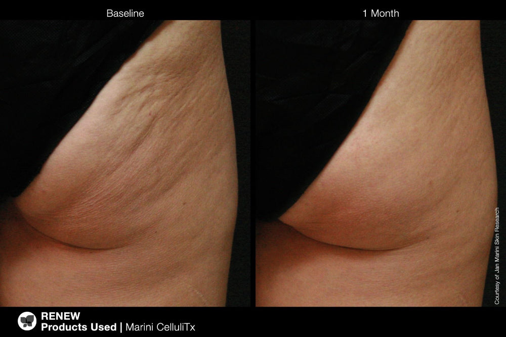 Marini CelluliTx Cellulite Cream Jan Marini 114g (vista 4)