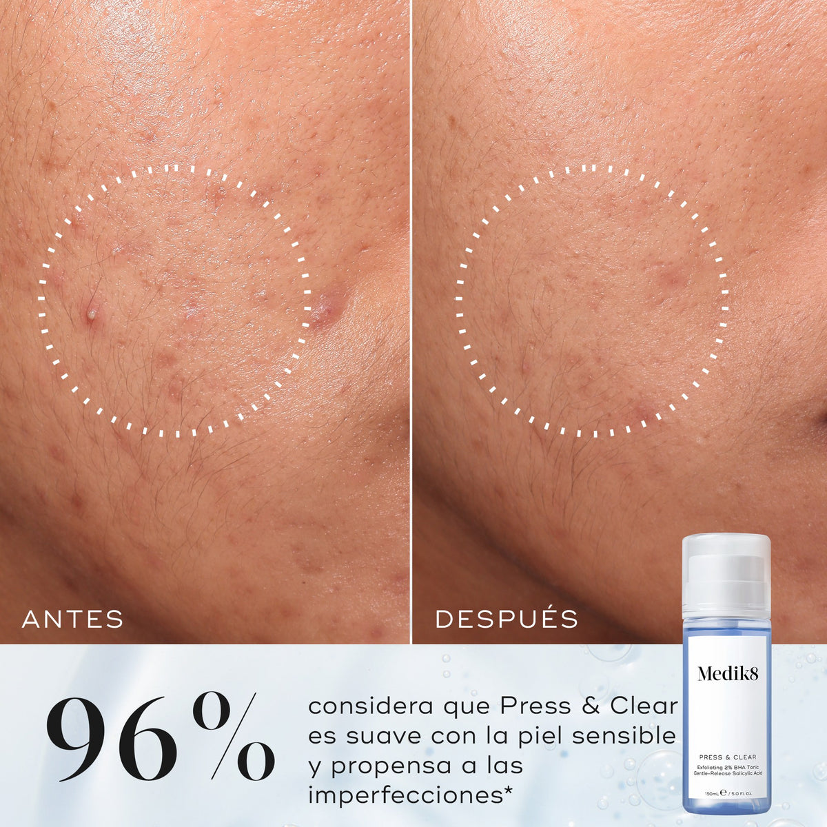 Press & Clear 150ml Medik8 — imagen 5