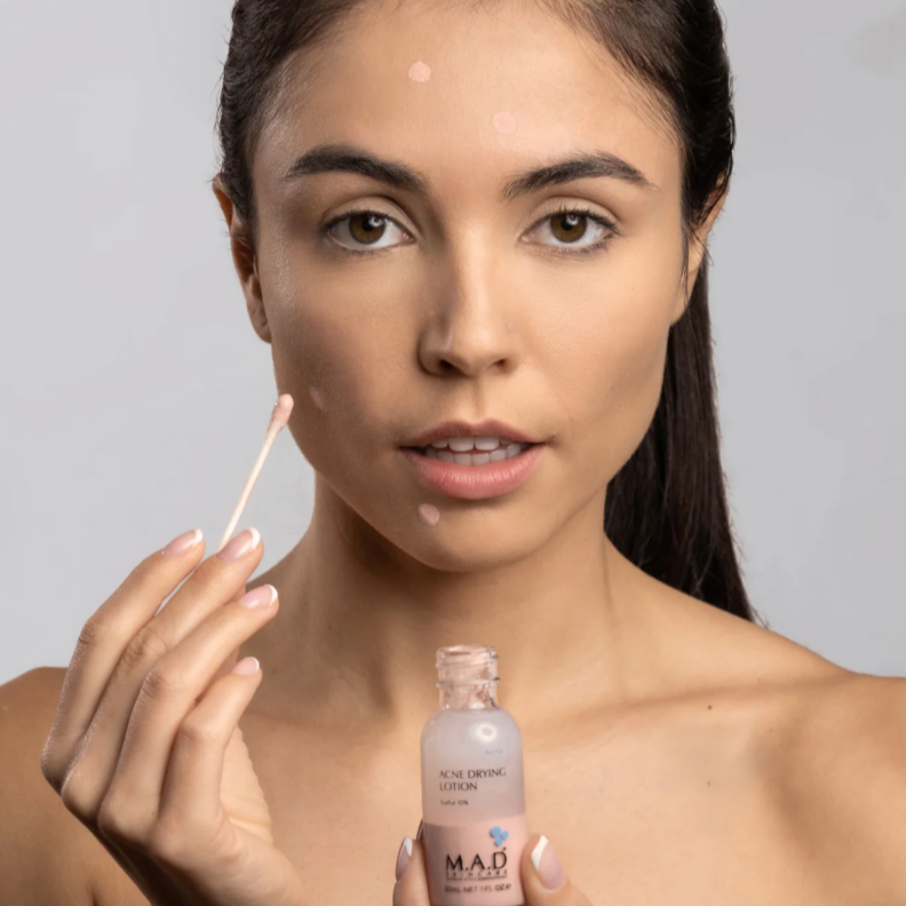 Acne Drying Lotion MAD 30ml - M.A.D (vista 2)